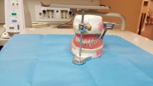 dentures gum porcelain